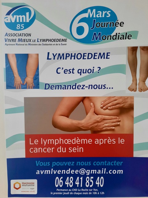 Lire la suite à propos de l’article La Roche sur Yon – Journée Mondiale du Lymphœdème avec AVML Vendée – 2023 (Compte rendu)